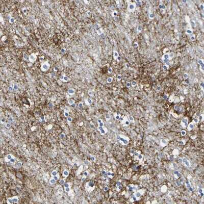 Immunohistochemistry-Paraffin: Otoferlin Antibody [NBP1-85233]