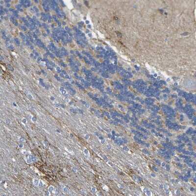 Immunohistochemistry-Paraffin: Otoferlin Antibody [NBP1-85233]