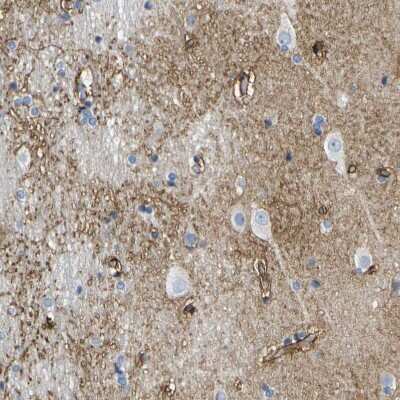Immunohistochemistry-Paraffin: Otoferlin Antibody [NBP1-85233]