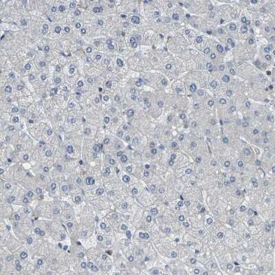 Immunohistochemistry-Paraffin: Otoferlin Antibody [NBP1-85233]