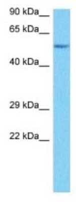 Western Blot: Otolin-1 Antibody [NBP3-10193]