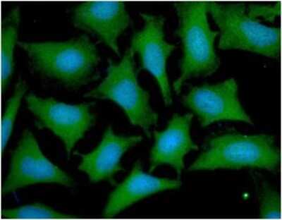 Immunocytochemistry/ Immunofluorescence: Otubain-1 Antibody (17E10) - BSA Free [NBP2-59389]