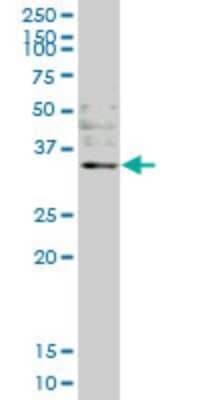 Western Blot: Otubain-1 Antibody (1C12) [H00055611-M09]