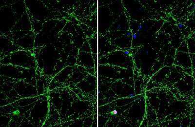 Immunocytochemistry/ Immunofluorescence: Otubain-1 Antibody (GT611) [NBP3-13627]