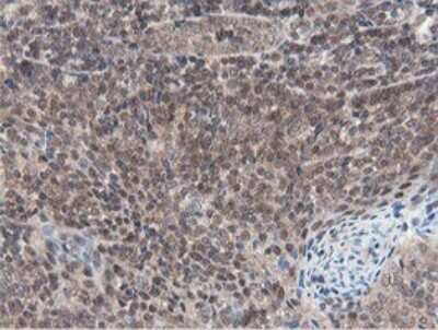 Immunohistochemistry: Otubain-1 Antibody (OTI5B8) [NBP2-45879]