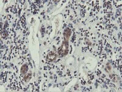 Immunohistochemistry: Otubain-1 Antibody (OTI5B8) [NBP2-45879]
