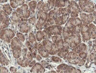 Immunohistochemistry: Otubain-1 Antibody (OTI5B8) [NBP2-45879]