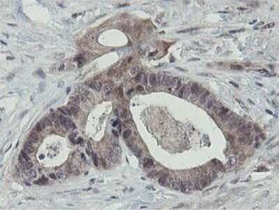 Immunohistochemistry: Otubain-1 Antibody (OTI5B8) [NBP2-45879]