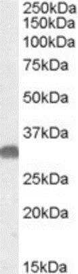 Western Blot: Otubain-1 Antibody [NBP1-20957]