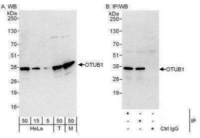 Western Blot: Otubain-1 Antibody [NBP1-49934]