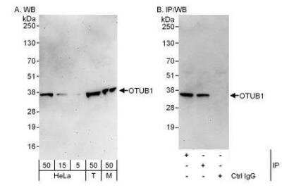 Western Blot: Otubain-1 Antibody [NBP1-49935]