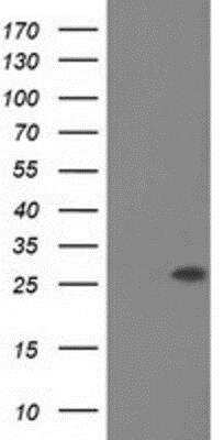 Western Blot: Otubain-2 Antibody (OTI11B3) [NBP2-03223]