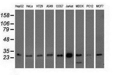 Western Blot: Otubain-2 Antibody (OTI11B3) [NBP2-03223]