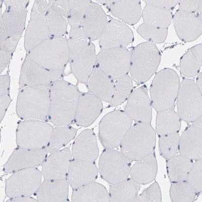 Immunohistochemistry-Paraffin: Otubain-2 Antibody [NBP1-88410]