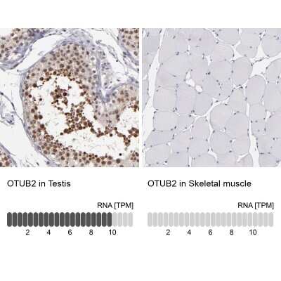 Immunohistochemistry-Paraffin: Otubain-2 Antibody [NBP1-88410]