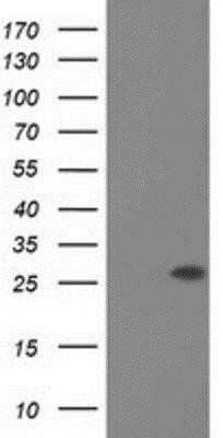 Western Blot: Otubain-2 Antibody (OTI11B3)Azide and BSA Free [NBP2-73172]