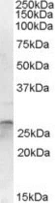 Western Blot: Otubain-2 Antibody [NBP1-20958]