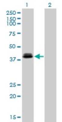Western Blot: Otx1 Antibody (1F2) [H00005013-M01]