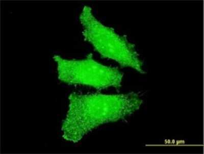 Immunocytochemistry/ Immunofluorescence: Otx1 Antibody (3D12) [H00005013-M06]