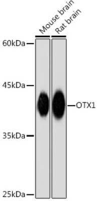 Western Blot: Otx1 Antibody (6H7J9) [NBP3-15884]