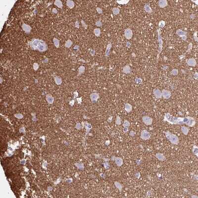Immunohistochemistry-Paraffin: Otx1 Antibody [NBP2-49034]