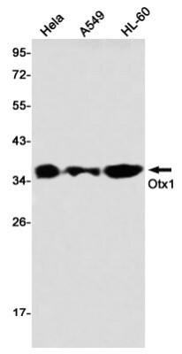 Western Blot: Otx1 Antibody (S04-1D1) [NBP3-19902]