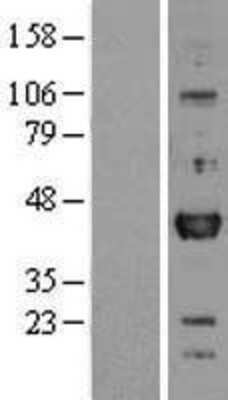Western Blot: Otx1 Overexpression Lysate [NBL1-14014]