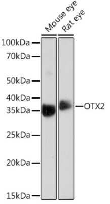 Western Blot: Otx2 Antibody (6I3J0) [NBP3-16384]