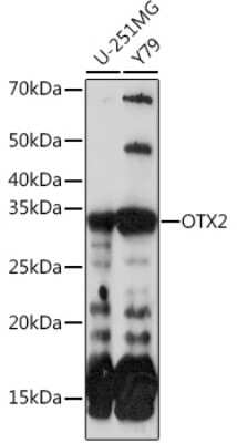 Western Blot: Otx2 Antibody (6I3J0) [NBP3-16384]