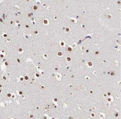 Immunohistochemistry-Paraffin: Otx2 Antibody [NBP1-86533]