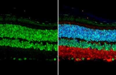Immunohistochemistry-Paraffin: Otx2 Antibody [NBP3-13176]