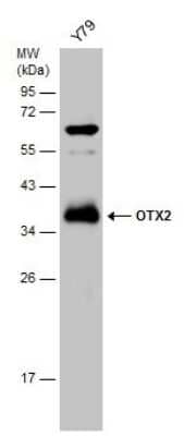 Western Blot: Otx2 Antibody [NBP3-13176]