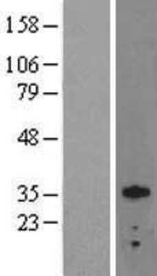 Western Blot: Otx2 Overexpression Lysate [NBL1-14015]