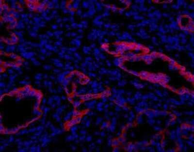 Immunohistochemistry: Oval Cell Marker Antibody (MIC1-1C3) - Azide and BSA Free [NBP2-80896]