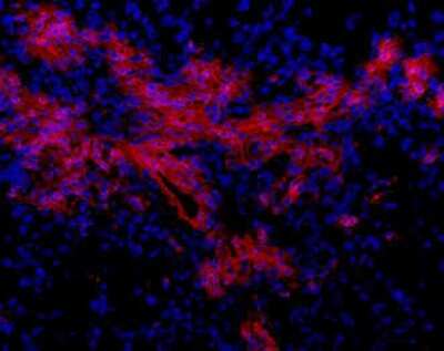 Immunohistochemistry: Oval Cell Marker Antibody (OC2-3C5) [NBP1-18968]