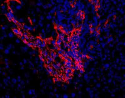 Immunohistochemistry: Oval Cell Marker Antibody (OC2-3C7) [NBP1-18970]