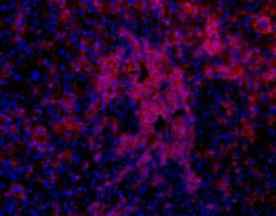 Immunohistochemistry: Oval Cell Marker Antibody (OC2-4E8) [NBP1-18971]