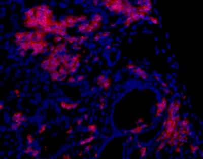 Immunohistochemistry: Oval Cell Marker Antibody (OC2-6E10) [NBP1-18981]