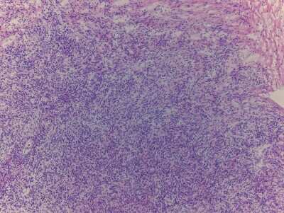 Hematoxylin & Eosin Stain: Ovary Tissue Slides (Adult Normal)- Frozen [NBP2-77580]