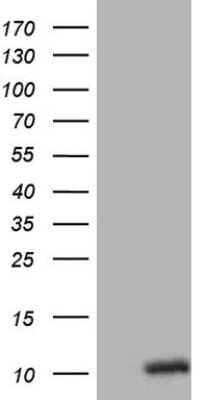 Western Blot: Oxytocin/Neurophysin I Antibody (OTI5G4) [NBP2-46308]