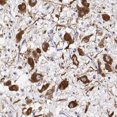 Immunohistochemistry-Paraffin: Oxytocin/Neurophysin I Antibody [NBP2-68928]