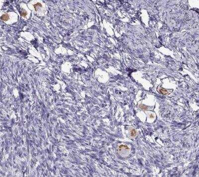 Immunohistochemistry-Paraffin: Oxytocin/Neurophysin I Antibody [NBP2-68928]
