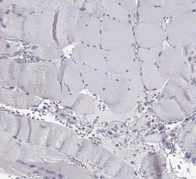 Immunohistochemistry-Paraffin: Oxytocin/Neurophysin I Antibody [NBP2-68928]