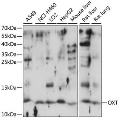 Western Blot: Oxytocin/Neurophysin I AntibodyAzide and BSA Free [NBP2-94626]