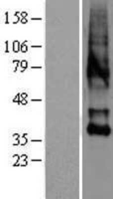 Western Blot: OXTR Overexpression Lysate [NBL1-14027]