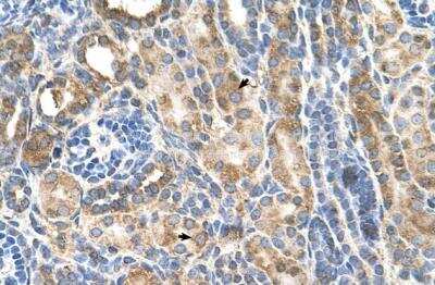 Immunohistochemistry-Paraffin: P-Cadherin Antibody [NBP1-59222]