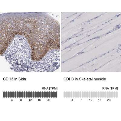 Immunohistochemistry-Paraffin: P-Cadherin Antibody [NBP1-85707]