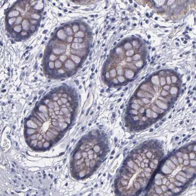 Immunohistochemistry-Paraffin: P-Cadherin Antibody [NBP1-85707]