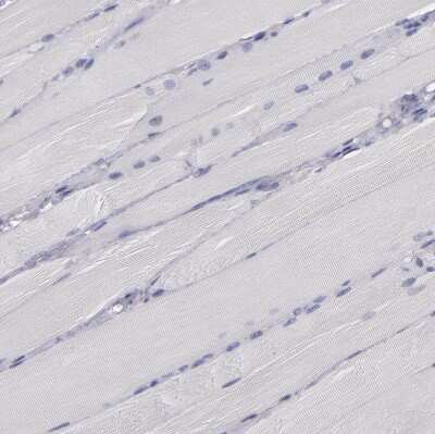 Immunohistochemistry-Paraffin: P-Cadherin Antibody [NBP1-85707]