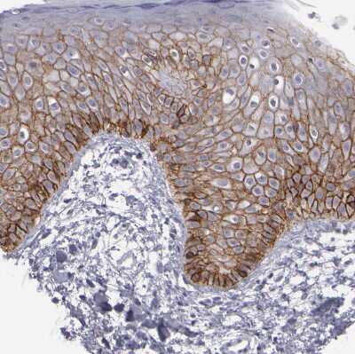 Immunohistochemistry-Paraffin: P-Cadherin Antibody [NBP1-85707]